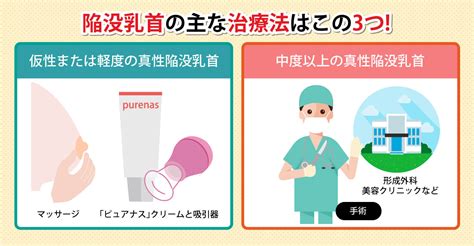 男性の陥没乳首（陥没乳頭）とは？治す方法の違い